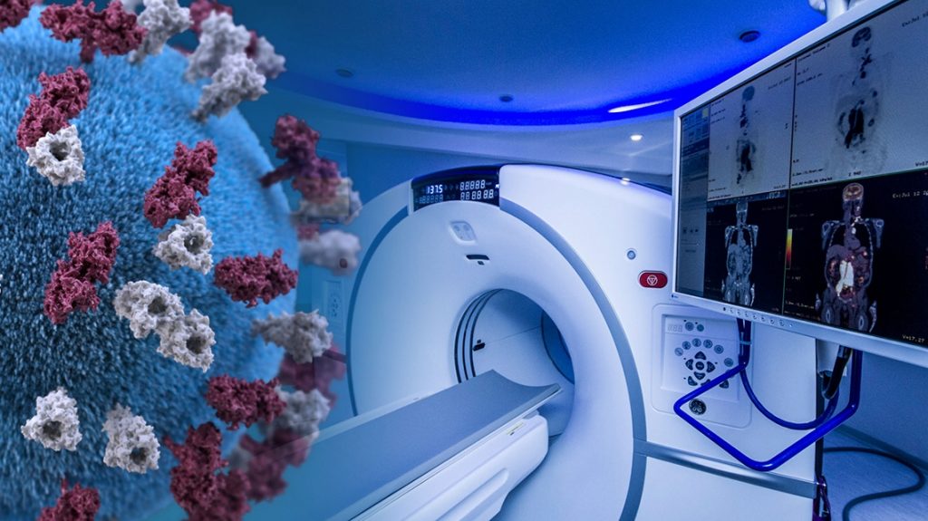 Qué Es La Medicina Nuclear 2 ¿Qué Son Los Radiotrazadores?