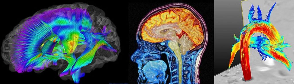 Qué Es La Medicina Nuclear 4 En La Adultez Se Aplica Para