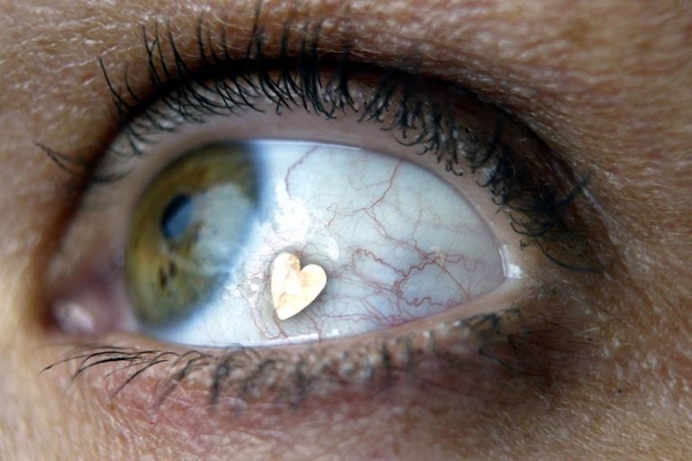 Consejos para evitar que esta ola de frío polar afecte a nuestra salud visual