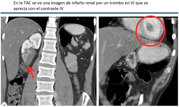 ¿Cómo Es El Proceso Para Realizar Un Tac?