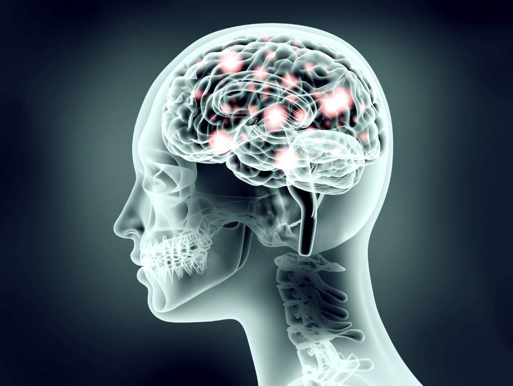 Daño a las neuronas