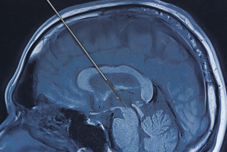 Un estudio abre la puerta a nuevas terapias para el Alzheimer, Parkinson o drogadicción