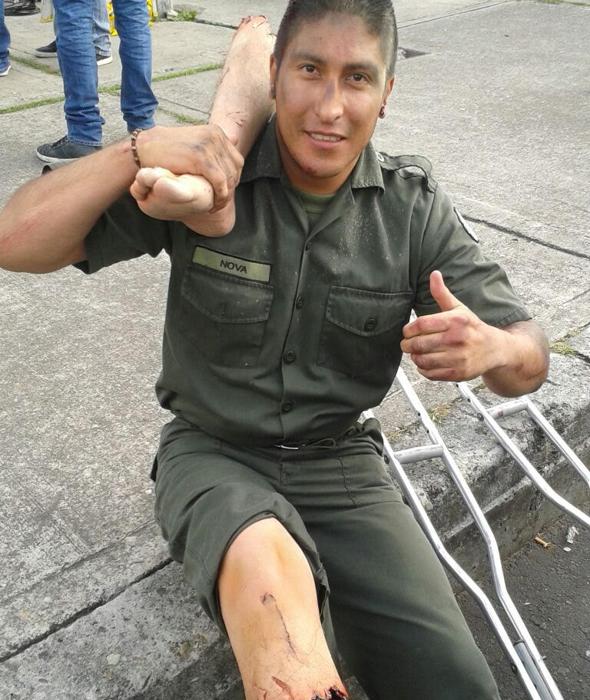 Mutilaciones De Miembros: