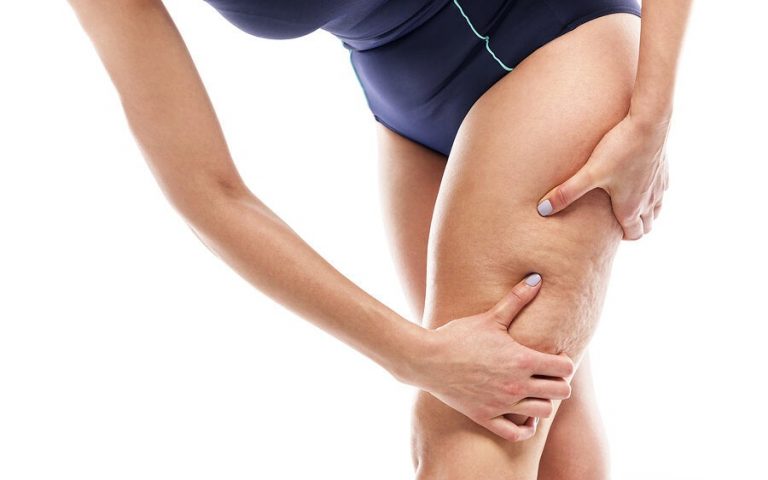 Cómo eliminar la celulitis de los muslos