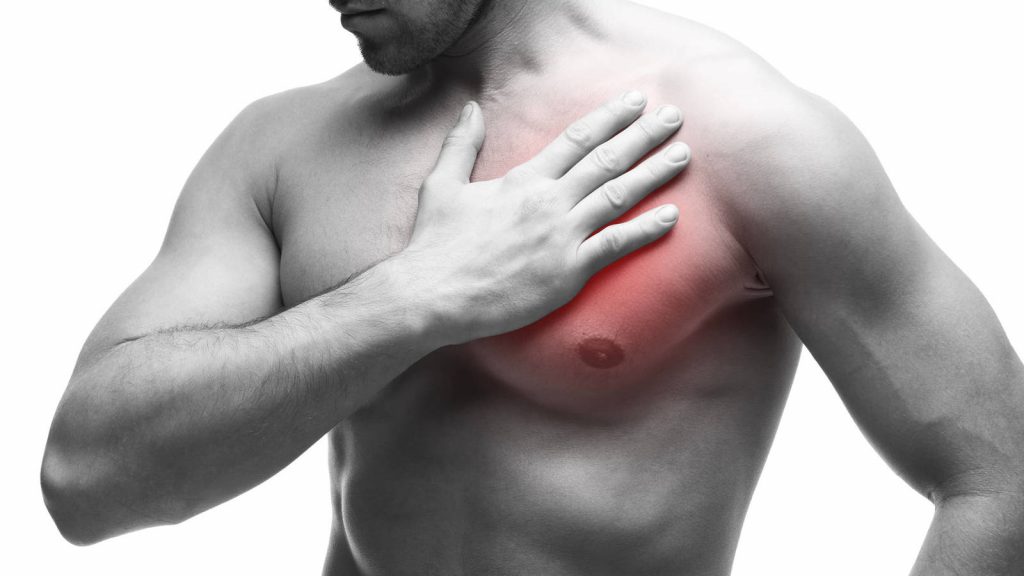 ¿Cómo Prevenir Un Infarto?