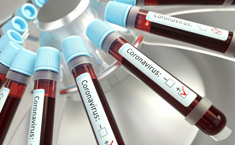 Los análisis de sangre podrían ser útiles para predecir la gravedad de la COVID-19