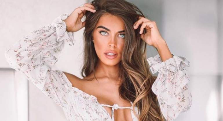 Los Labios Y Otros Retoques Que La Ha Vuelto Irreconocible