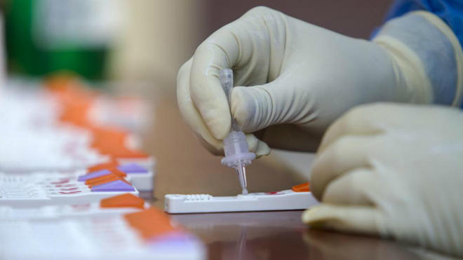 Pruebas Coronavirus Tokio 2020