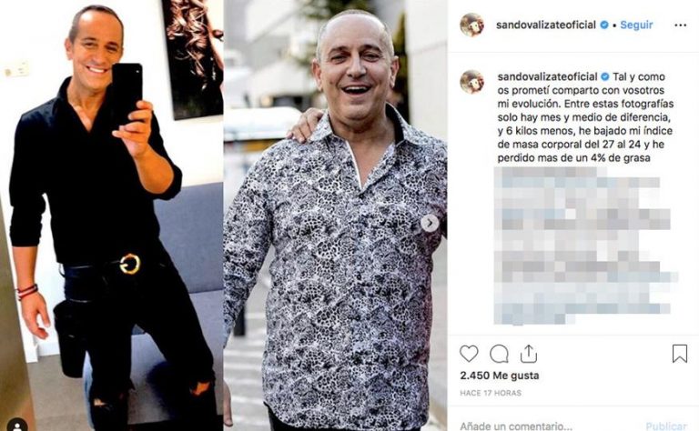 Víctor Sandoval, Anabel Pantoja y otros famosos que han optado por el balón intragástrico para «hacer trampa» y perder peso rápido