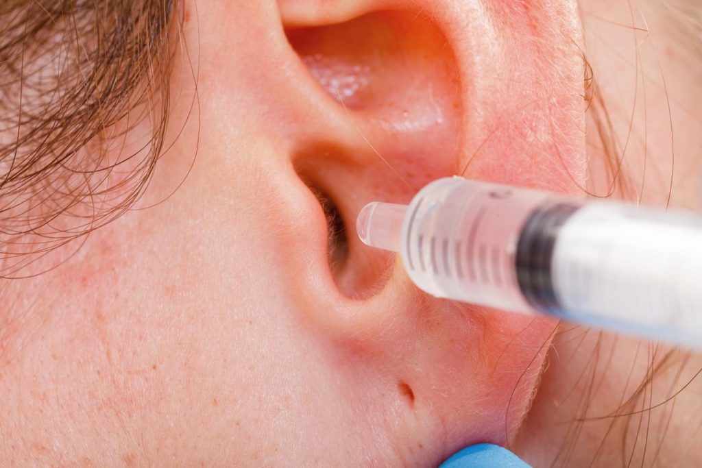 ¿Y Qué Hacer Cuándo Hay Un Tapón De Cerumen En Los Oídos?