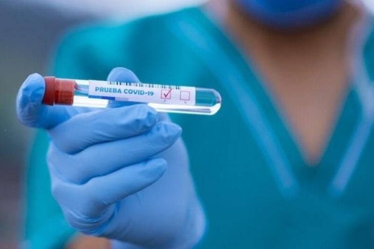 La Comunidad de Madrid notifica 409 casos nuevos