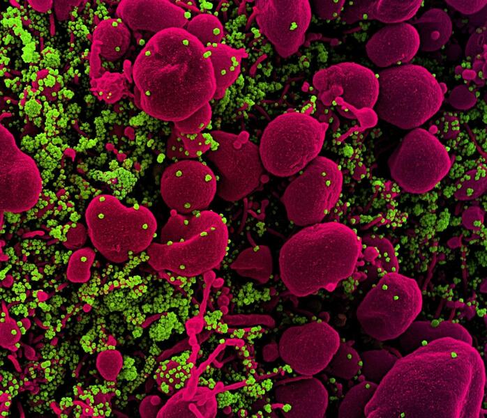 Estudio apunta que la variante británica es un 45% más contagiosa que el Covid original