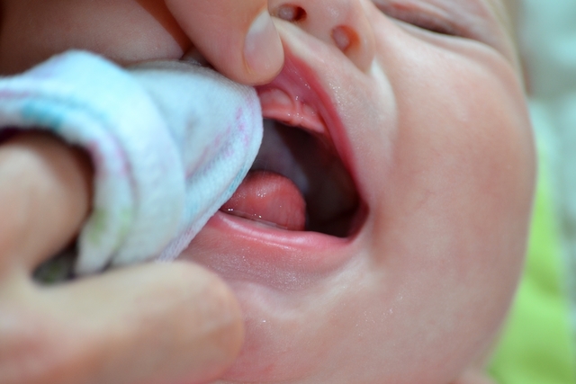 Dolor De Encías Y Primeros Dientes ¿Cuáles Son Los Síntomas?