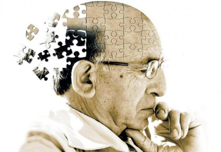 Cómo ralentizar el alzheimer