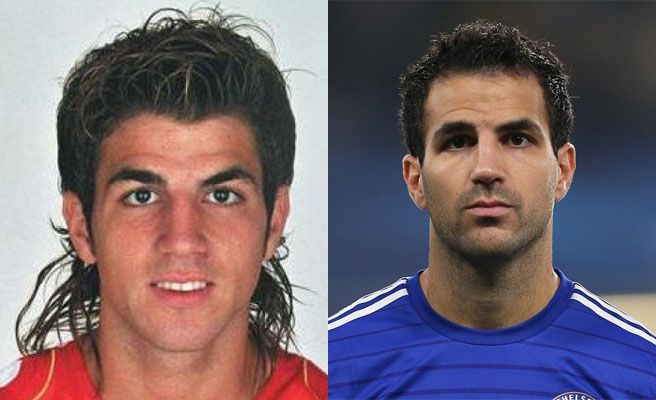 Así han cambiado los cracks del fútbol tras operarse los piños 06