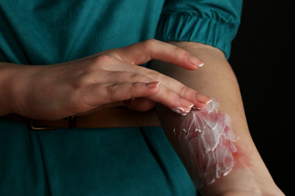 Productos Para Tipos De Heridas