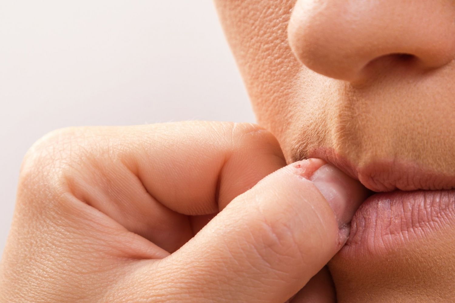 Qué Es La Dermatofagia 2 Dermatofagia