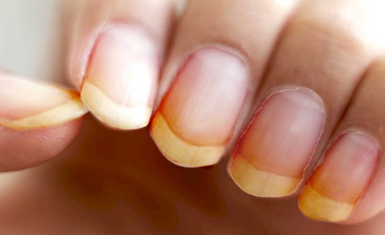 Cómo blanquear tus uñas