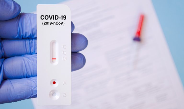Cómo hacerse el test de autodiagnóstico Covid-19 en casa