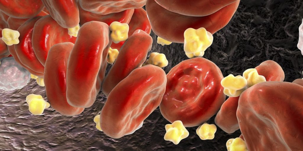 ¿Cuáles Son Los Factores Para Que Aumente El Colesterol?