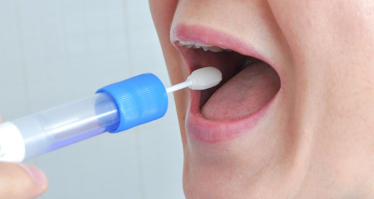 Proceso Del Diagnóstico Con Escupitajo