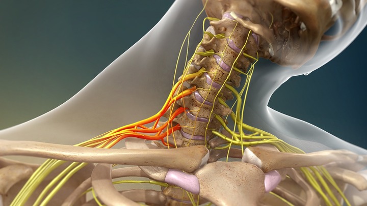 ¿Sufres De Neuralgia Del Plexo Braquial?