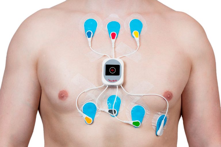 Qué es un holter para el corazón