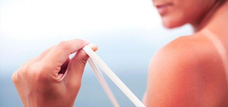 Cáncer de piel: la pandemia estética que se puede evitar