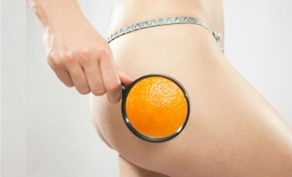 Celulitis: cremas y tratamientos que acaban con la piel de naranja