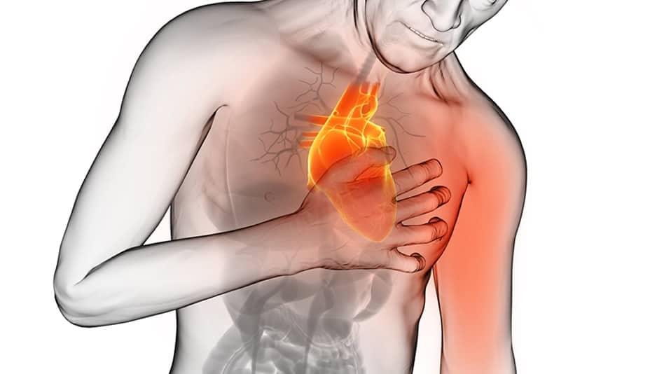 Qué Es La Pericarditis