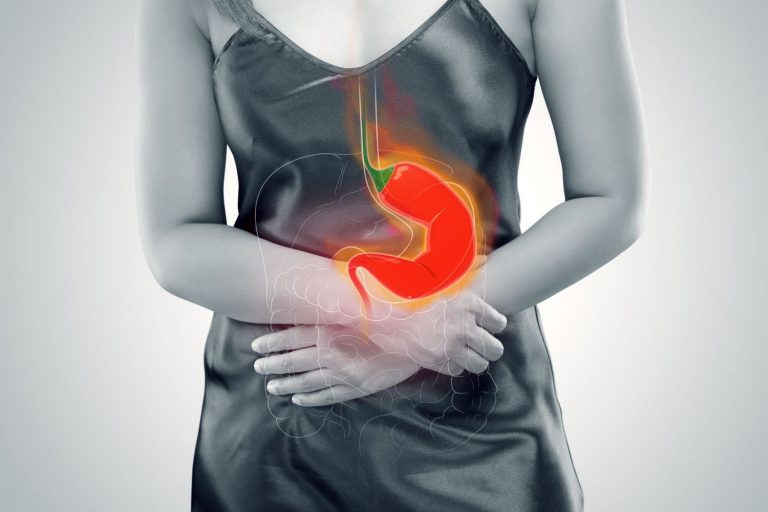 Qué es una hernia de hiato