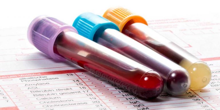 Qué son los hematocritos