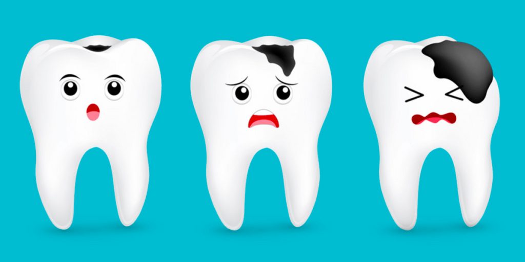 ¿Qué Origina Una Caries Realmente?