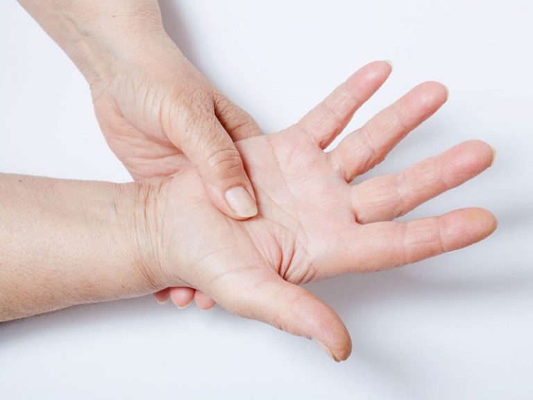 Los reumatólogos estiman que en España existen 13.000 pacientes con esclerodermia