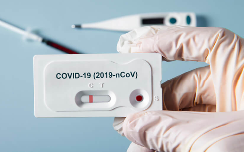 2019-Ncov Test Antígeno