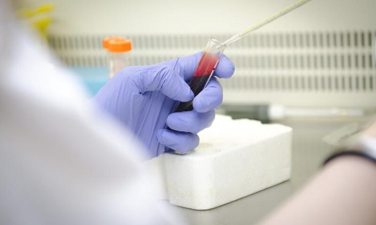 Investigadores españoles hallan biomarcadores celulares que predicen la mortalidad en pacientes con Covid-19