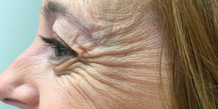 Cómo suavizar las arrugas de tu rostro