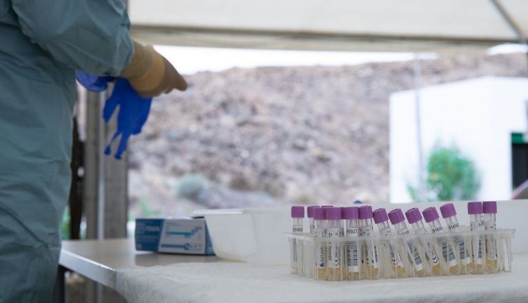 Canarias registra un nuevo repunte con 378 contagios en una jornada sin fallecidos