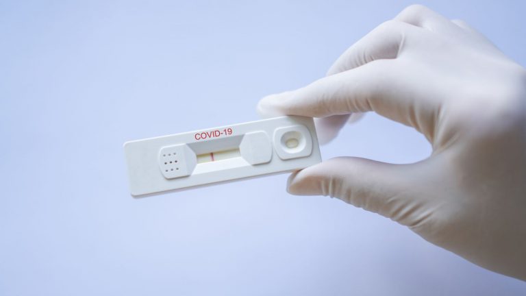 Farmacéuticos vuelven a pedir dispensar test Covid-19
