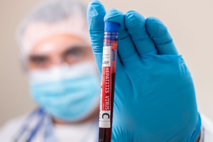 La vacuna contra la hepatitis C podría estar disponible en cinco años