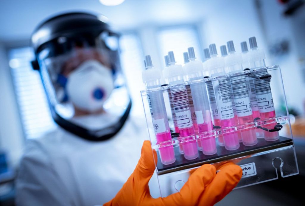 ¿Qué Es Un Test De Anticuerpos Para Covid- 19?
