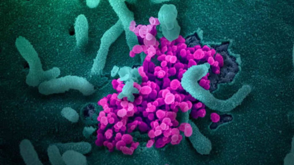 Puede Que Los Anticuerpos No Excluyan La Infección