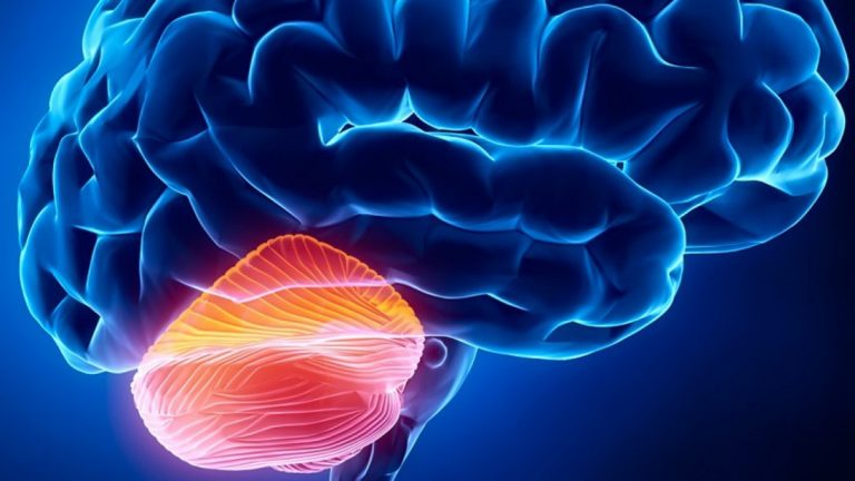 Qué es la ataxia