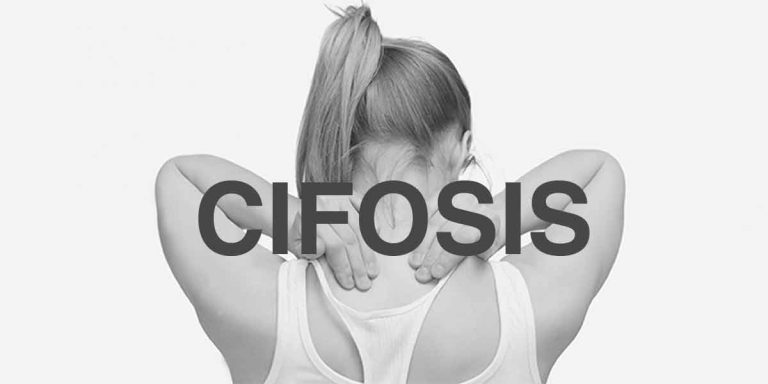 Qué es la cifosis