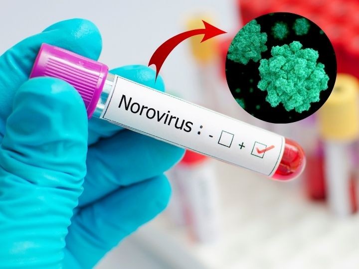 Qué es norovirus
