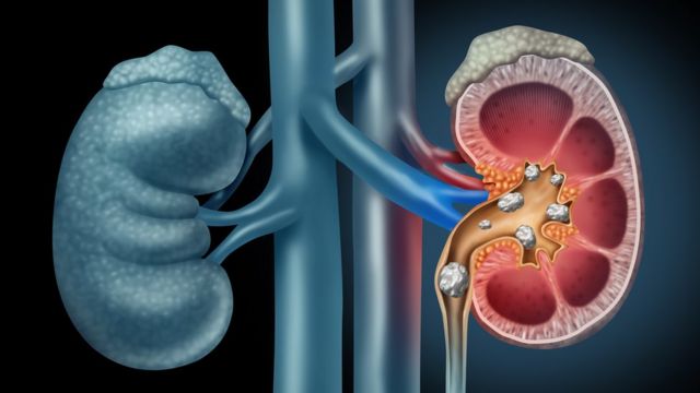 ¿Cómo Fluye La Sangre Por Los Riñones?