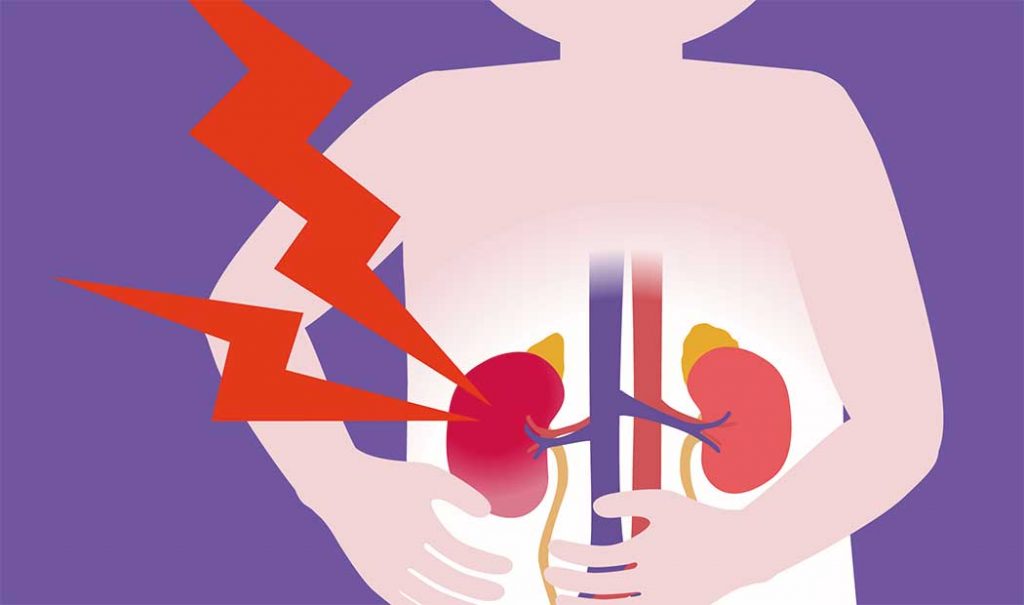 ¿Qué Es La Enfermedad Renal En Etapa Terminal?