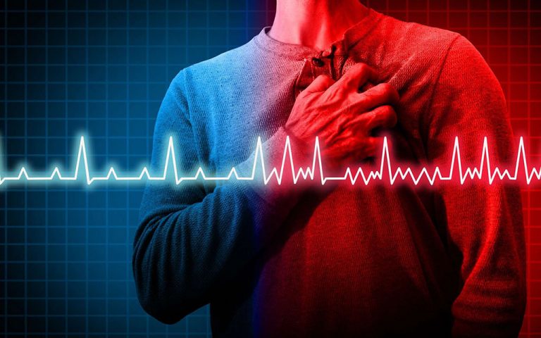 Qué pasa si tienes menos de 60 pulsaciones por minuto
