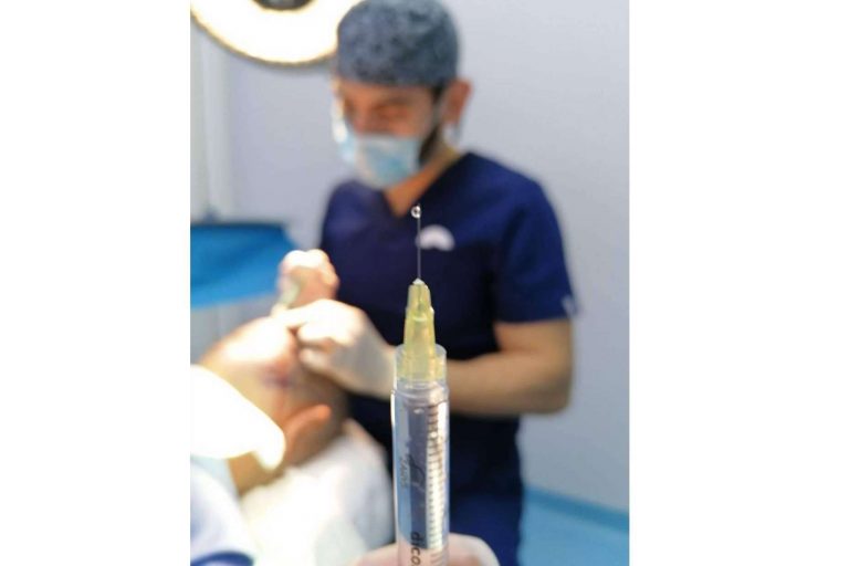 La técnica DHI empleada por el Dr. Bern permite conseguir resultados naturales en el trasplante capilar