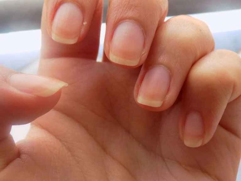 Cómo solucionar las uñas amarillas